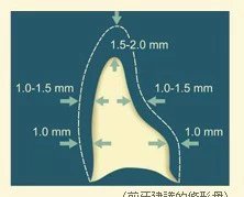 images/4/2017/05/FD32DD0FGD6ZEGWDNZNDZS7WD2DE7H.jpg