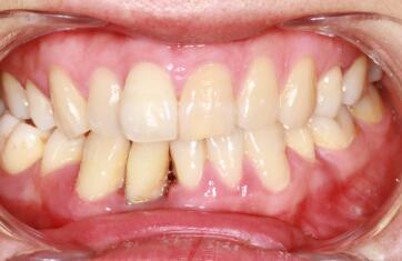 sys-case-1463469848195.jpg